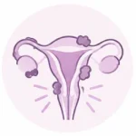 icono endometriosis