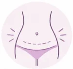 recuperación post cesárea